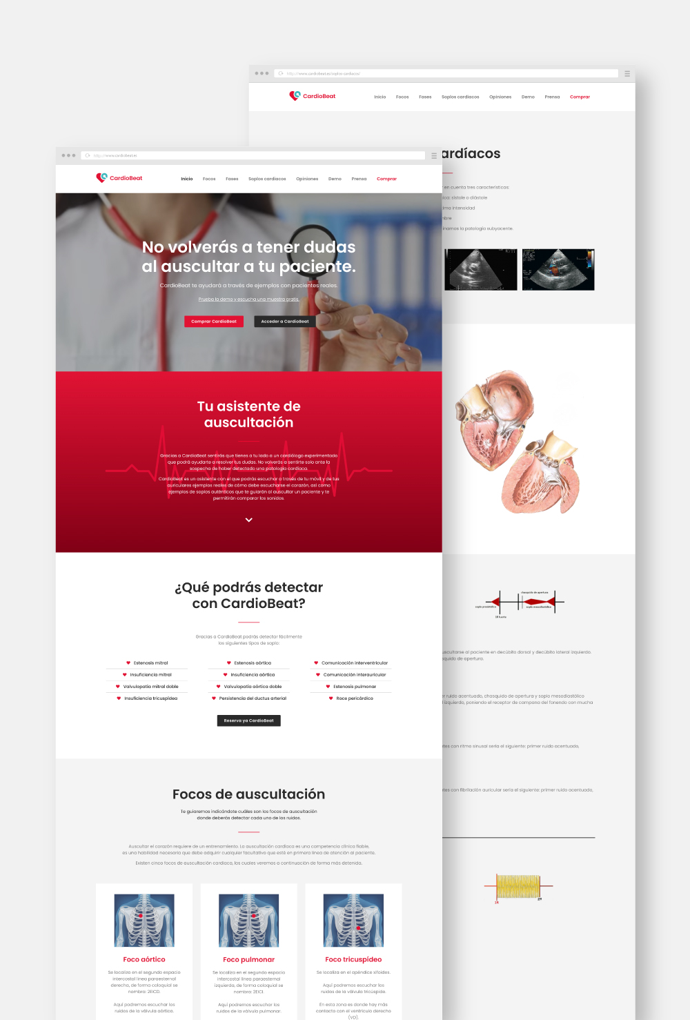 CardioBeat — imagen del proyecto